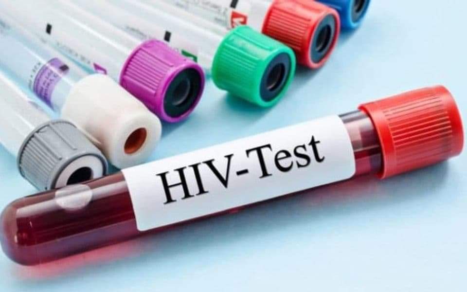 HIV test, sida